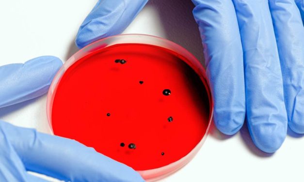 Südafrikanische Covid-19-Mutation tritt erstmalig in Granada auf